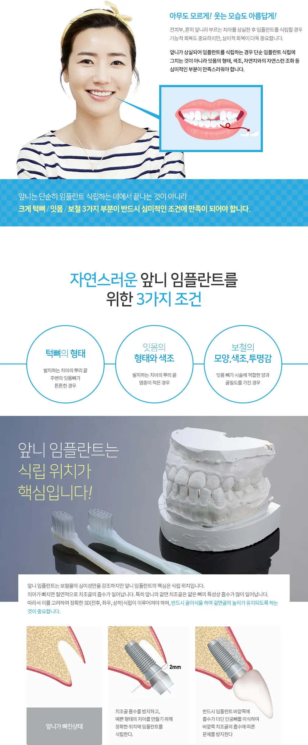 05 incisor1 — 일등플란트치과의원